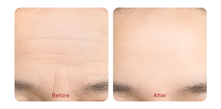 version_of_skin_03-2