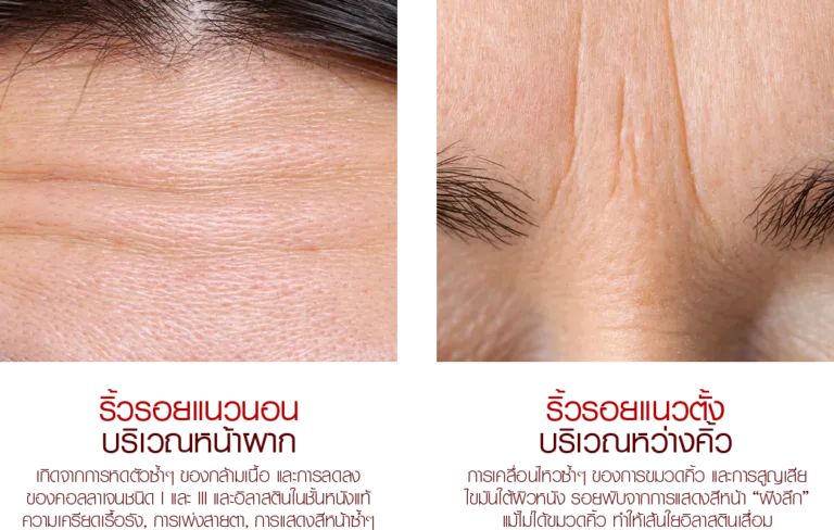 Trylagina_GENX_NEW_02_3